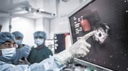 实时电磁导航设备 让医生开着“GPS”做手术