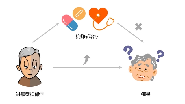 研究表明抑郁症增加51%阿尔茨海默病风险